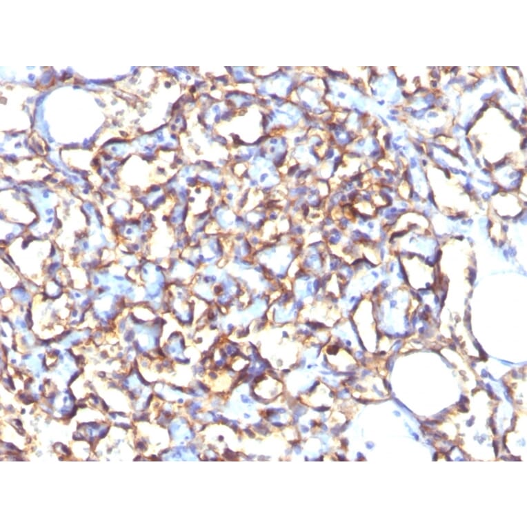Immunohistochemistry - Anti-Podocalyxin Antibody [3D3] (A249650) - Antibodies.com