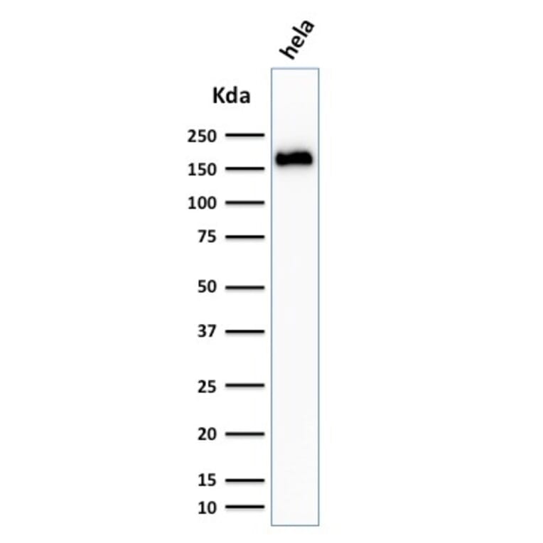 Western Blot - Anti-Podocalyxin Antibody [3D3] (A249650) - Antibodies.com