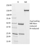 SDS-PAGE - Anti-Podocalyxin Antibody [3D3] (A249650) - Antibodies.com
