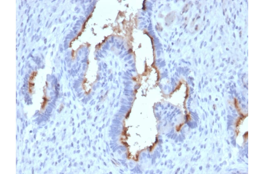 Immunohistochemistry - Anti-Podocalyxin Antibody [PODXL/2185] (A249652) - Antibodies.com