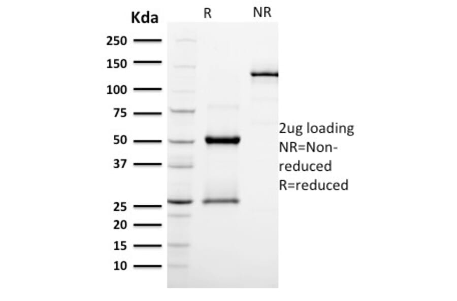 SDS-PAGE - Anti-Podocalyxin Antibody [PODXL/2185] (A249652) - Antibodies.com