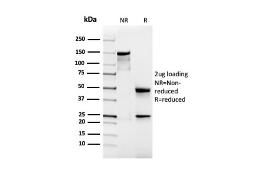 SDS-PAGE - Anti-Podocalyxin Antibody [rPODXL/2184] (A249652) - Antibodies.com