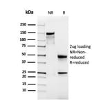 SDS-PAGE - Anti-Podocalyxin Antibody [rPODXL/2184] (A249652) - Antibodies.com