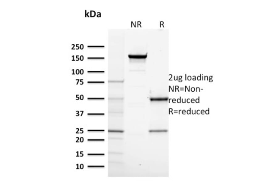 SDS-PAGE - Anti-RNA Polymerase II CTD repeat YSPTSPS Antibody [CTD4H8] (A249654) - Antibodies.com