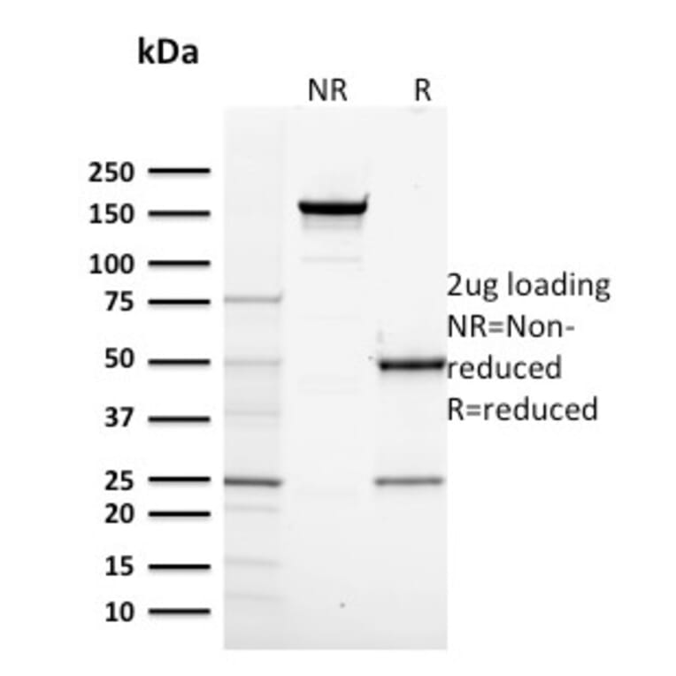 SDS-PAGE - Anti-RNA Polymerase II CTD repeat YSPTSPS Antibody [CTD4H8] (A249654) - Antibodies.com