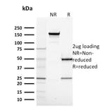 SDS-PAGE - Anti-RNA Polymerase II CTD repeat YSPTSPS Antibody [CTD4H8] (A249654) - Antibodies.com