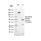 SDS-PAGE - Anti-ACTH Antibody [rCLIP/1407] (A249655) - Antibodies.com