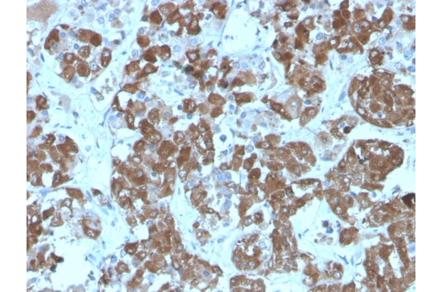 Immunohistochemistry - Anti-ACTH Antibody [rCLIP/1407] (A249654) - Antibodies.com
