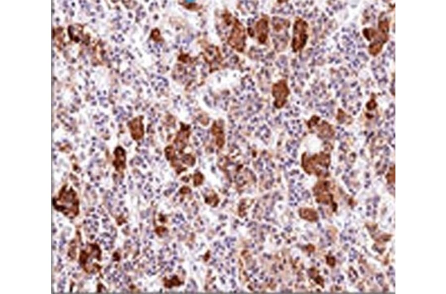 Immunohistochemistry - Anti-ACTH Antibody [AH26] (A249656) - Antibodies.com