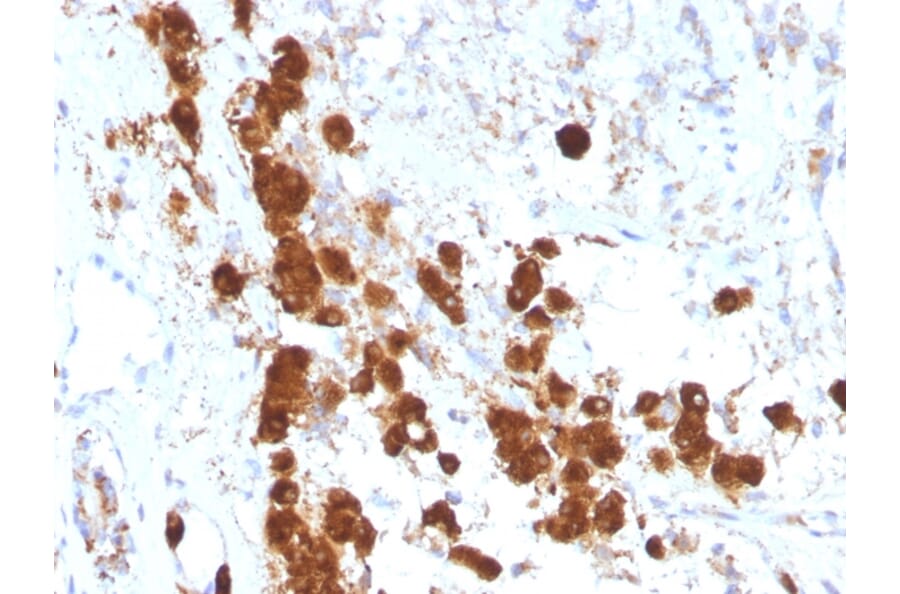 Immunohistochemistry - Anti-ACTH Antibody [SPM333] (A249657) - Antibodies.com