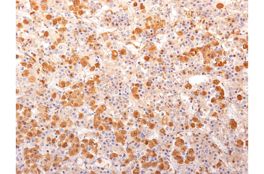 Immunohistochemistry - Anti-ACTH Antibody [57] (A249659) - Antibodies.com