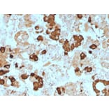 Immunohistochemistry - Anti-ACTH Antibody [57] (A249658) - Antibodies.com