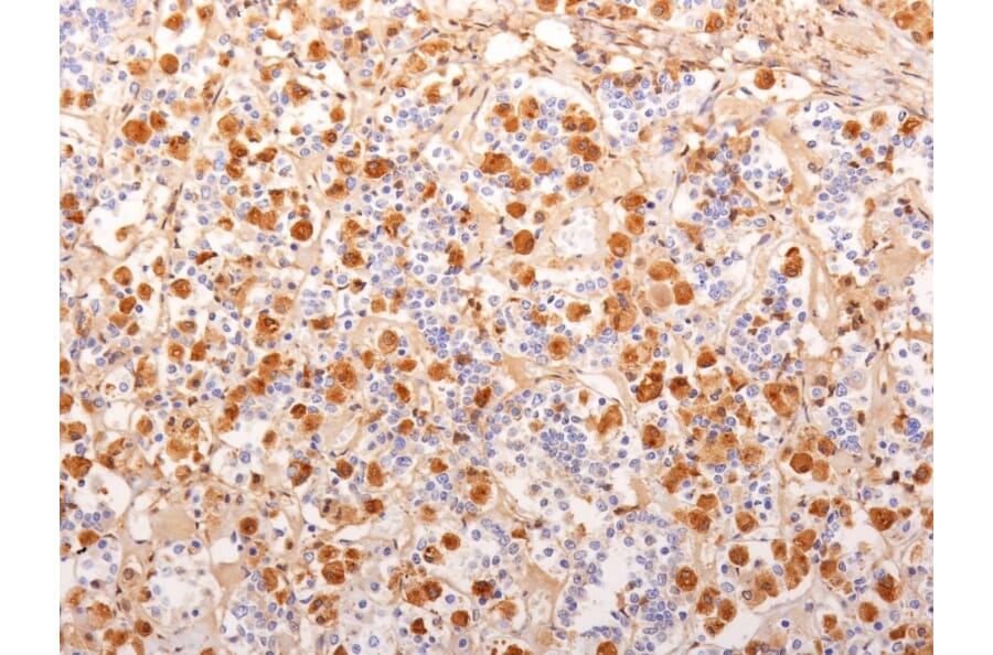 Immunohistochemistry - Anti-ACTH Antibody [2F6] (A249659) - Antibodies.com