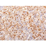 Immunohistochemistry - Anti-ACTH Antibody [2F6] (A249659) - Antibodies.com