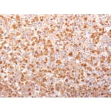 Immunohistochemistry - Anti-ACTH Antibody [AH26 + 57] (A252839) - Antibodies.com