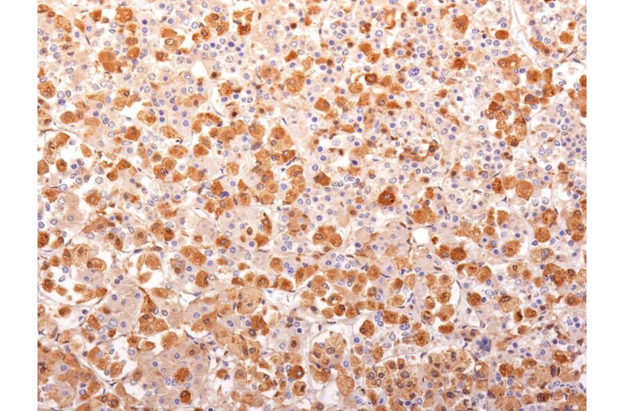 Immunohistochemistry - Anti-ACTH Antibody [r57] (A249661) - Antibodies.com