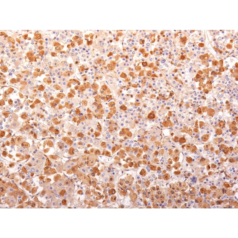 Immunohistochemistry - Anti-ACTH Antibody [r57] (A249661) - Antibodies.com