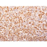 Immunohistochemistry - Anti-ACTH Antibody [r57] (A249661) - Antibodies.com