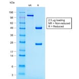 SDS-PAGE - Anti-ACTH Antibody [r57] (A249662) - Antibodies.com