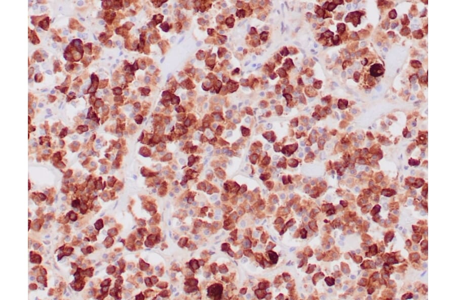 Immunohistochemistry - Anti-ACTH Antibody [CLIP/1407] (A249662) - Antibodies.com