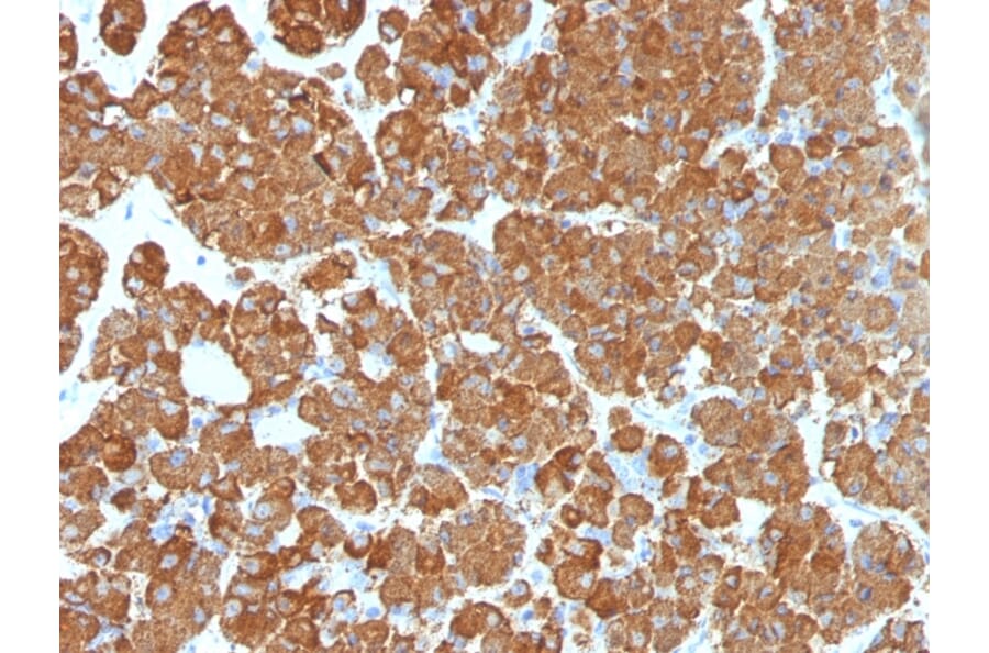 Immunohistochemistry - Anti-ACTH Antibody [CLIP/1407] (A249663) - Antibodies.com