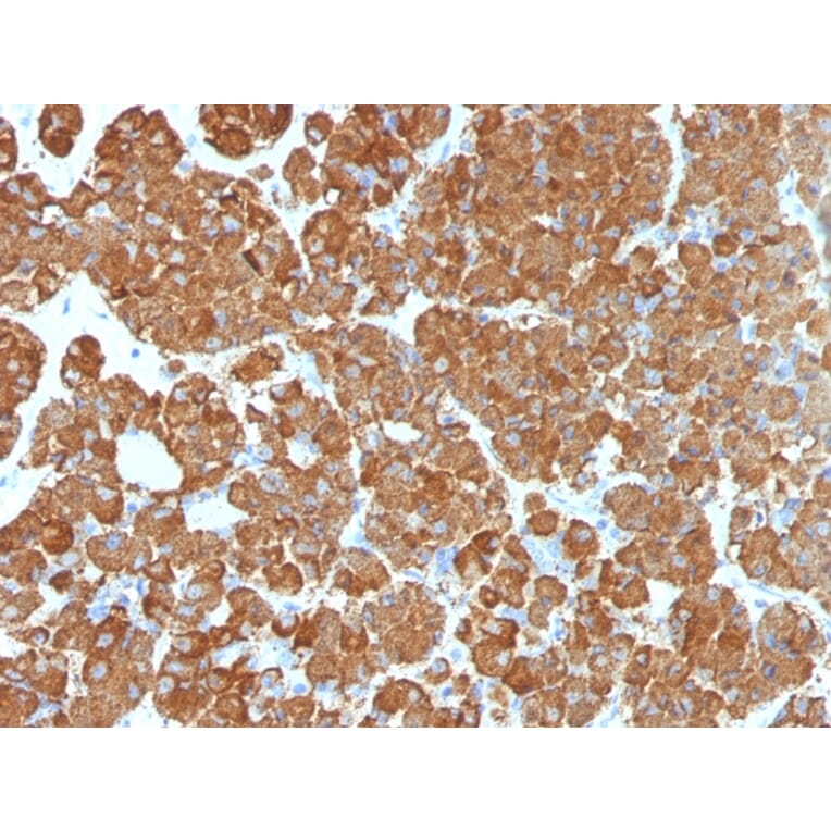 Immunohistochemistry - Anti-ACTH Antibody [CLIP/1407] (A249663) - Antibodies.com