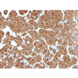 Immunohistochemistry - Anti-ACTH Antibody [CLIP/1407] (A249663) - Antibodies.com