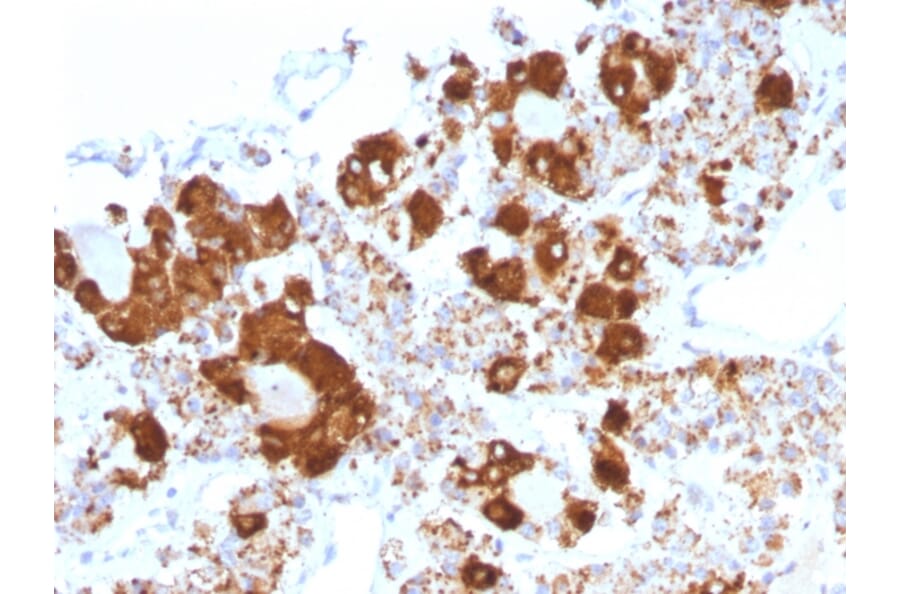 Immunohistochemistry - Anti-ACTH Antibody [CLIP/1407] (A249663) - Antibodies.com