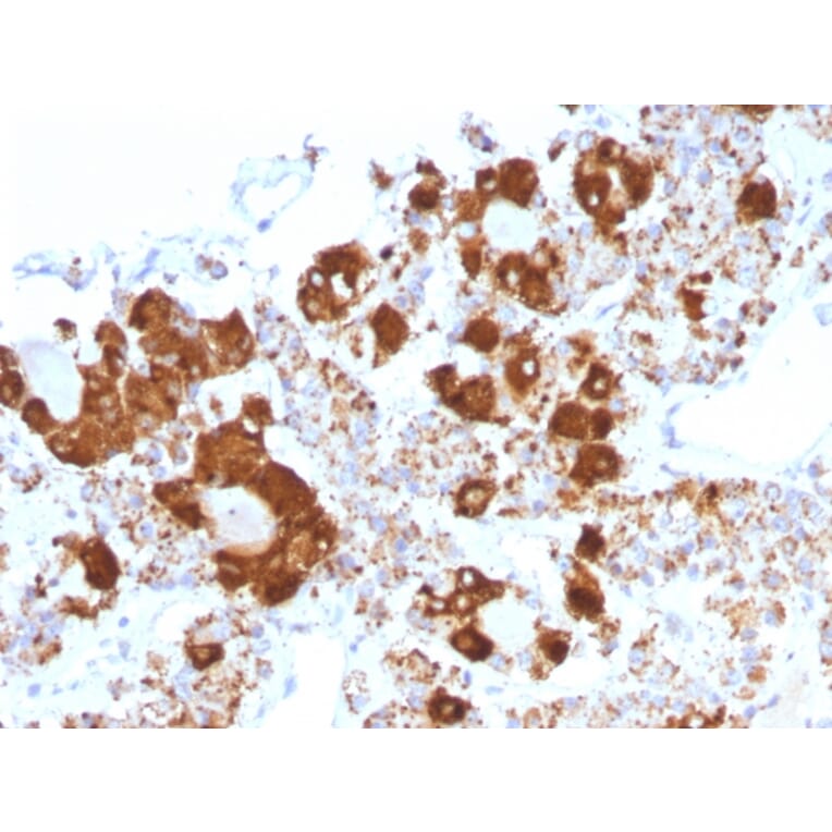 Immunohistochemistry - Anti-ACTH Antibody [CLIP/1407] (A249663) - Antibodies.com