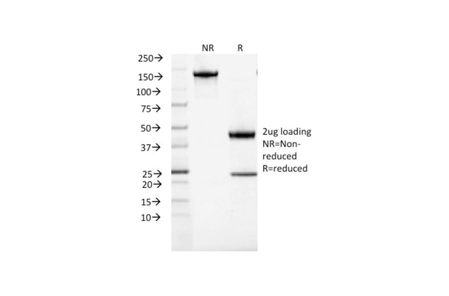 SDS-PAGE - Anti-ACTH Antibody [CLIP/1407] (A249663) - Antibodies.com