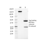 SDS-PAGE - Anti-ACTH Antibody [CLIP/1407] (A249663) - Antibodies.com
