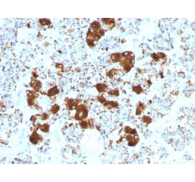 Immunohistochemistry - Anti-ACTH Antibody [SPM501] (A249663) - Antibodies.com