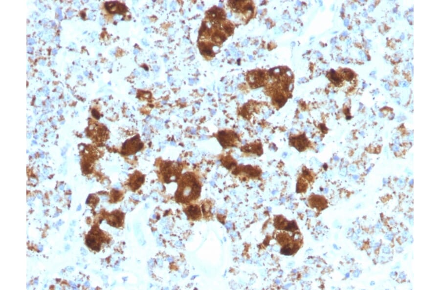 Immunohistochemistry - Anti-ACTH Antibody [SPM501] (A249663) - Antibodies.com