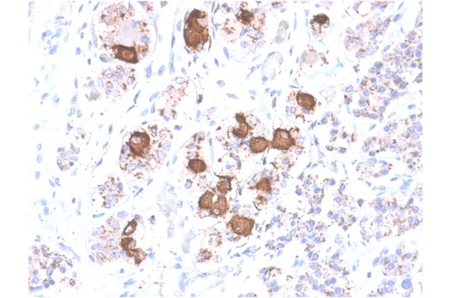 Immunohistochemistry - Anti-ACTH Antibody [CLIP/2040R] (A249666) - Antibodies.com