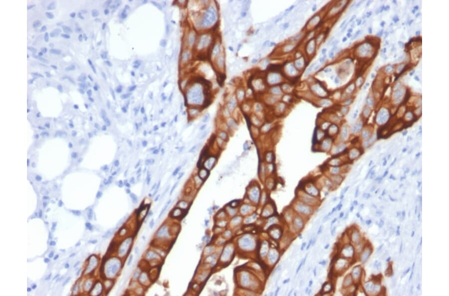 Immunohistochemistry - Anti-Cytokeratin 20 Antibody [KRT20/1991] (A249669) - Antibodies.com