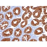 Immunohistochemistry - Anti-Cytokeratin 20 Antibody [KRT20/1991] (A249669) - Antibodies.com