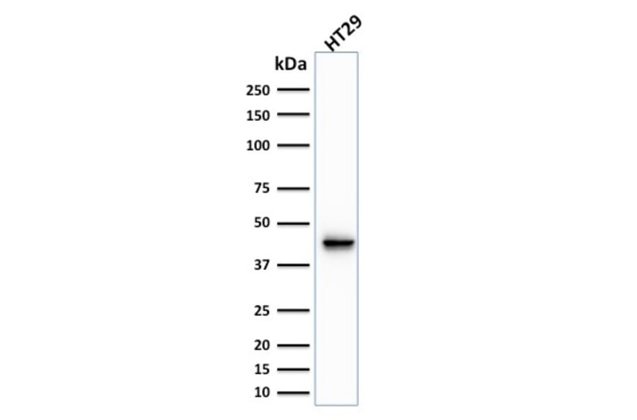 Western Blot - Anti-Cytokeratin 20 Antibody [KRT20/1991] (A249669) - Antibodies.com