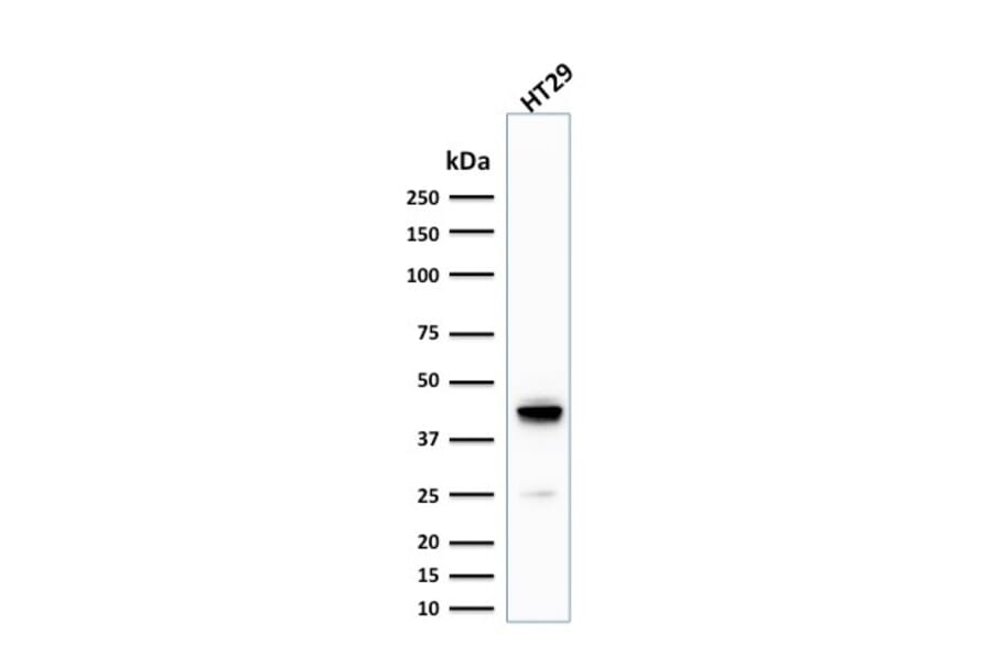 Western Blot - Anti-Cytokeratin 20 Antibody [KRT20/1992] (A249670) - Antibodies.com
