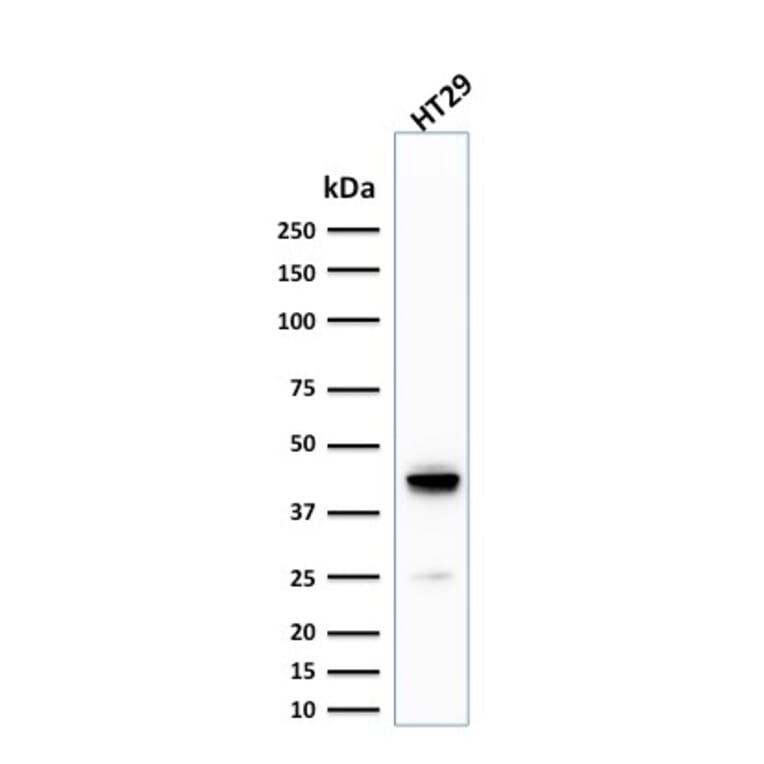 Western Blot - Anti-Cytokeratin 20 Antibody [KRT20/1992] (A249670) - Antibodies.com