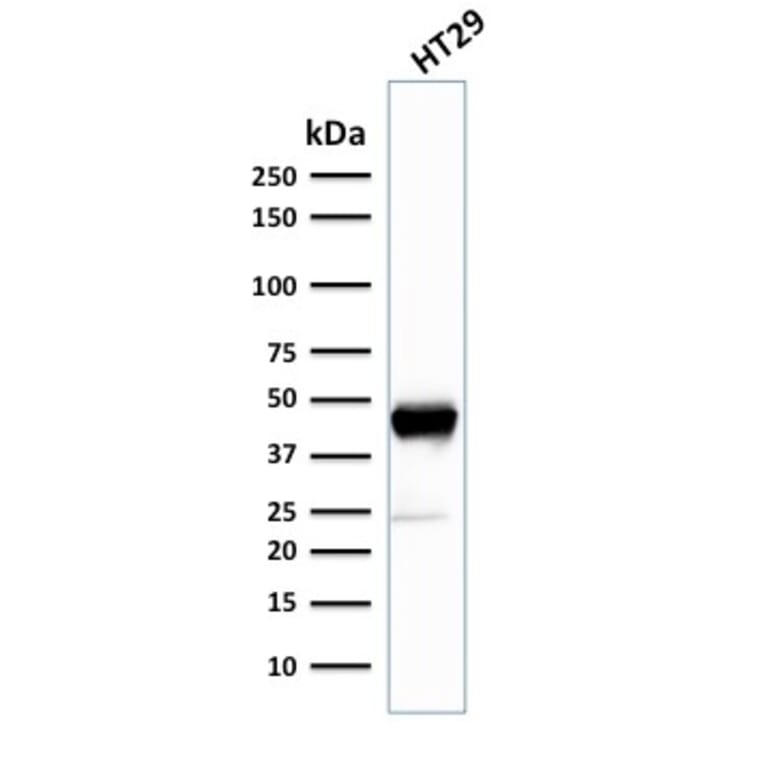 Western Blot - Anti-Cytokeratin 20 Antibody [SPM140] (A249671) - Antibodies.com