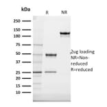 SDS-PAGE - Anti-Cytokeratin 20 Antibody [SPM140] (A249671) - Antibodies.com