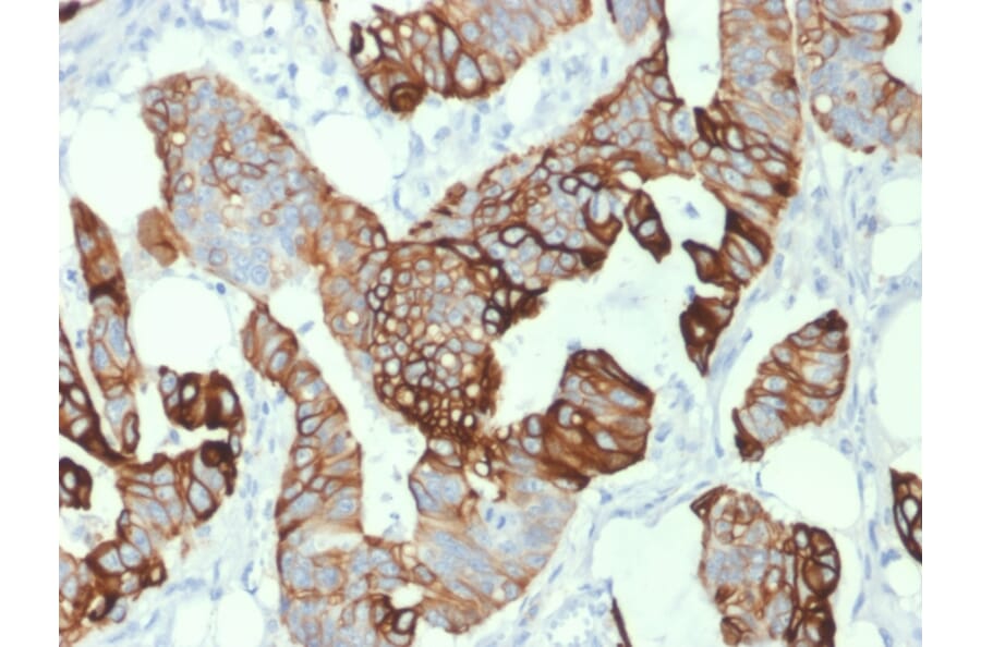 Immunohistochemistry - Anti-Cytokeratin 20 Antibody [KRT20/1993] (A249672) - Antibodies.com