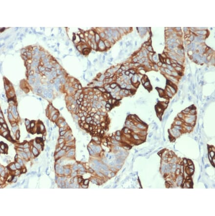 Immunohistochemistry - Anti-Cytokeratin 20 Antibody [KRT20/1993] (A249672) - Antibodies.com