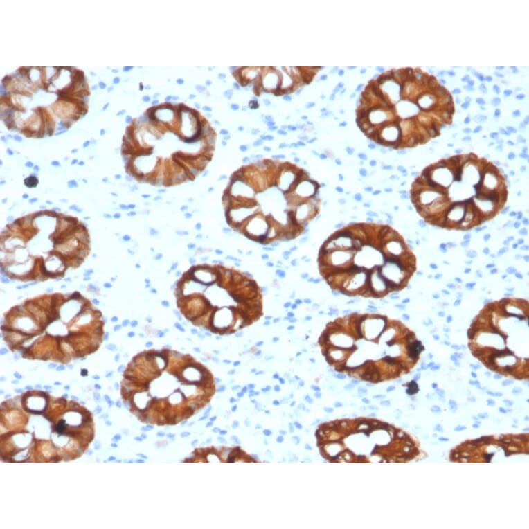 Immunohistochemistry - Anti-Cytokeratin 20 Antibody [KRT20/1993] (A249672) - Antibodies.com