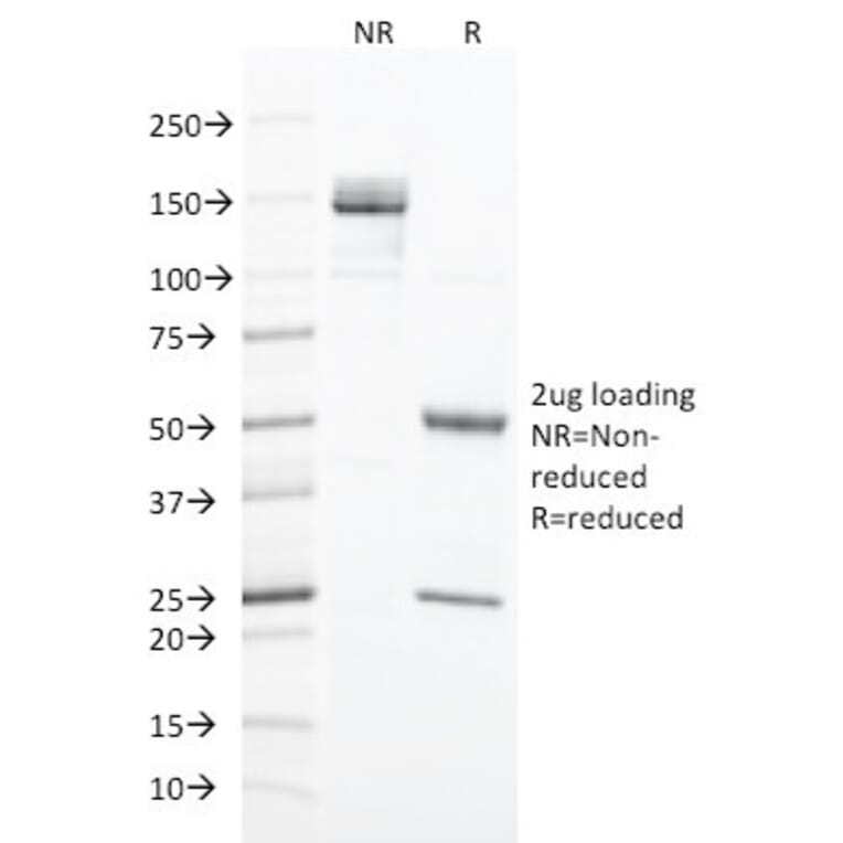 SDS-PAGE - Anti-Cytokeratin 20 Antibody [KRT20/1993] (A249672) - Antibodies.com