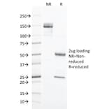 SDS-PAGE - Anti-Cytokeratin 20 Antibody [KRT20/1993] (A249672) - Antibodies.com