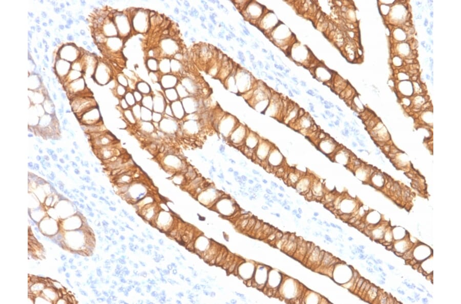 Immunohistochemistry - Anti-Cytokeratin 20 Antibody [SPM191] (A249672) - Antibodies.com