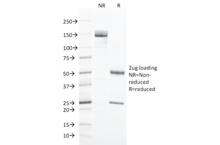 SDS-PAGE - Anti-Cytokeratin 20 Antibody [SPM191] (A249673) - Antibodies.com