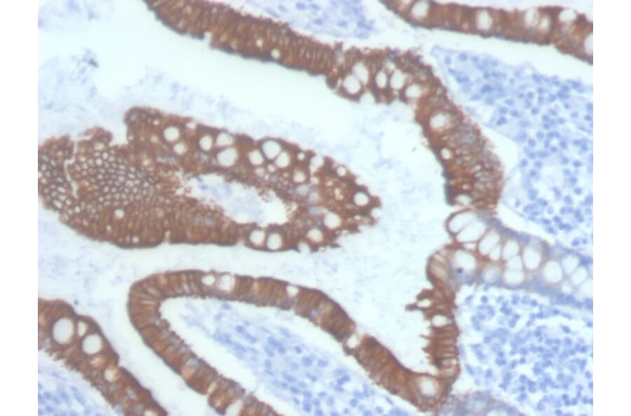Immunohistochemistry - Anti-Cytokeratin 20 Antibody [KRT20/3145] (A249673) - Antibodies.com