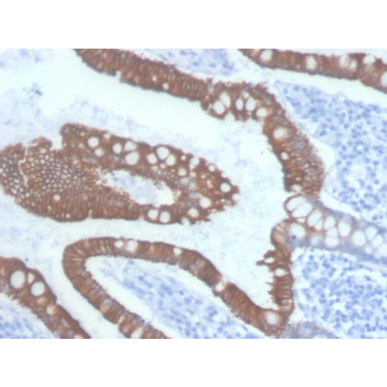 Immunohistochemistry - Anti-Cytokeratin 20 Antibody [KRT20/3145] (A249673) - Antibodies.com